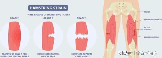 东契奇选择欧洲治疗引争议 美专家质疑技术差异